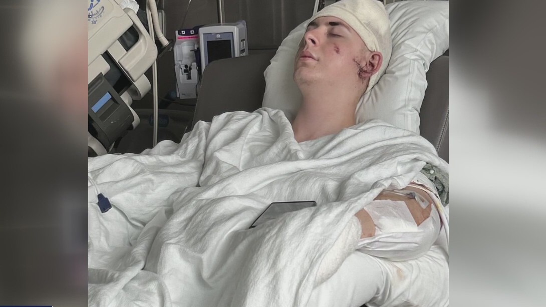 Machete attack survivor reacts to no trial